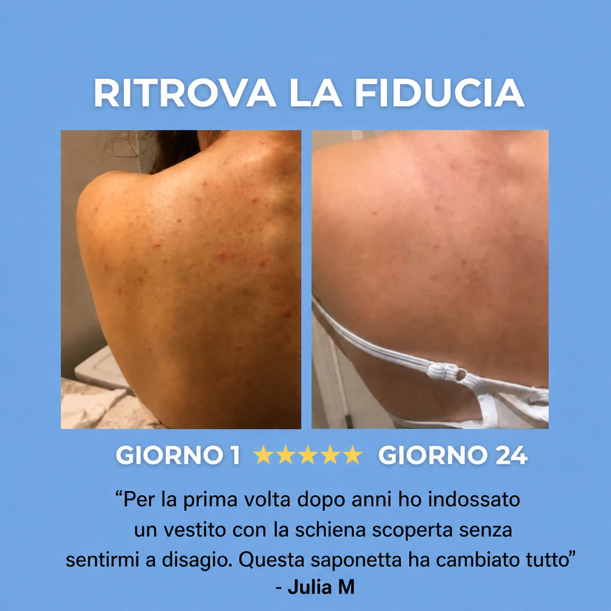 SAPONE ANTI-ACNE™