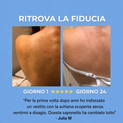 SAPONE ANTI-ACNE™