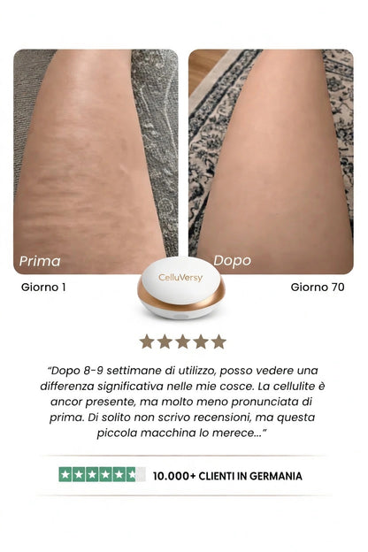CelluVersy™ – pelle levigata in 14 giorni